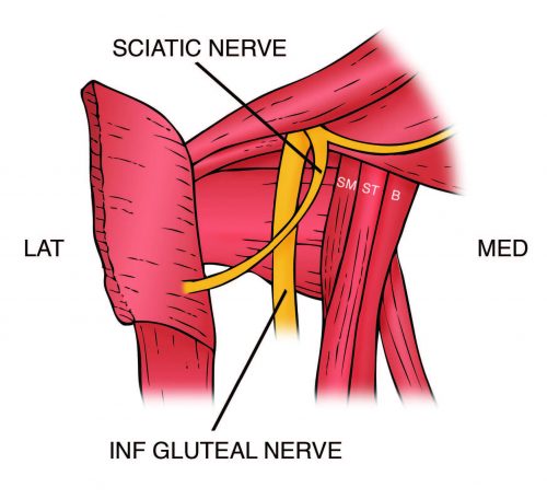 Anatomy of the Proximal Hamstring - El Paso Chiropractor