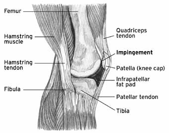 Infrapatellar Fat Pad Diagram - El Paso Chiropractor