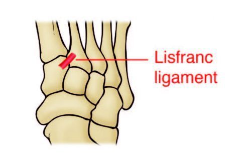 Lisfranc Ligament Anatomy Diagram - El Paso Chiropractor