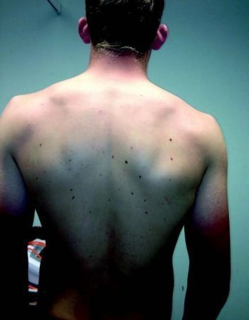 Standing Posture - El Paso Chiropractor