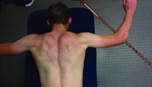 SLAP Lesion Treatment - El Paso Chiropractor