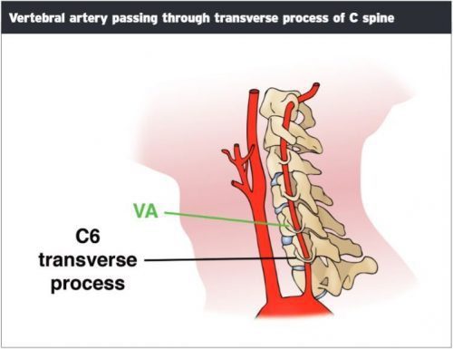 Vertebral Artery Passing Transverse Process - El Paso Chiropractor