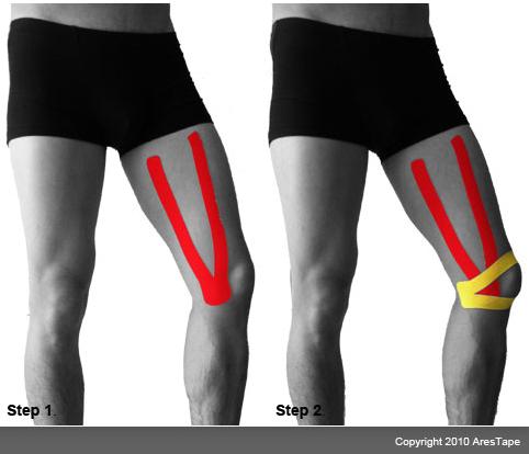 blog picture of male lower body in two stages with kinesiotape applied to the knee and inner thigh