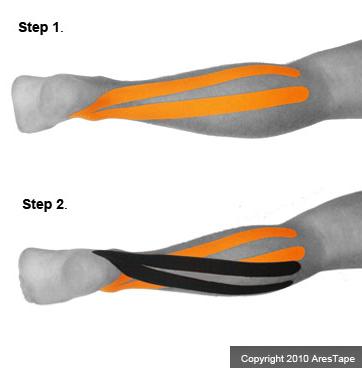 blog picture of male calves in two stages with kinesiotape applied to the calves