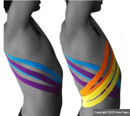 two blog pictures of male upper body with kenisiotape applied to the rib area