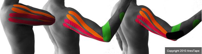 blog picture of male upper body with kinesiotape applied to shoulder and elbow