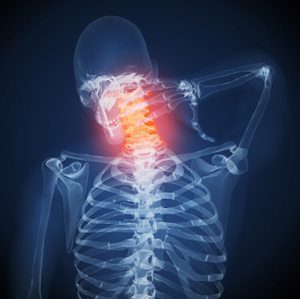 blog picture of x-ray skeleton grabbing back of neck in pain
