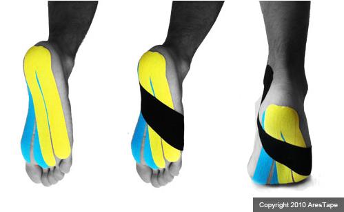 blog picture of male foot with kinesiotape applied to bottom of foot