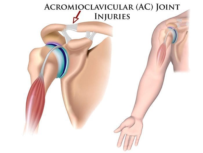 anatomía del hombro articulación acromioclavicular