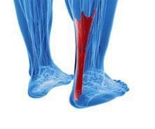 Ankle Tendonitis