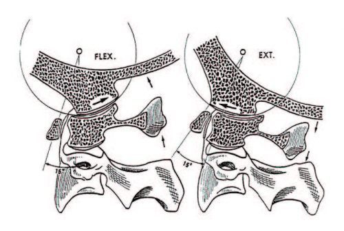 cervicogenic headaches Flexion Rotation Assessment - El Paso Chiropractor