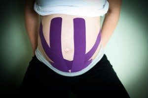 blog picture of pregnant lady's stomach with kinesiotape strips around belly