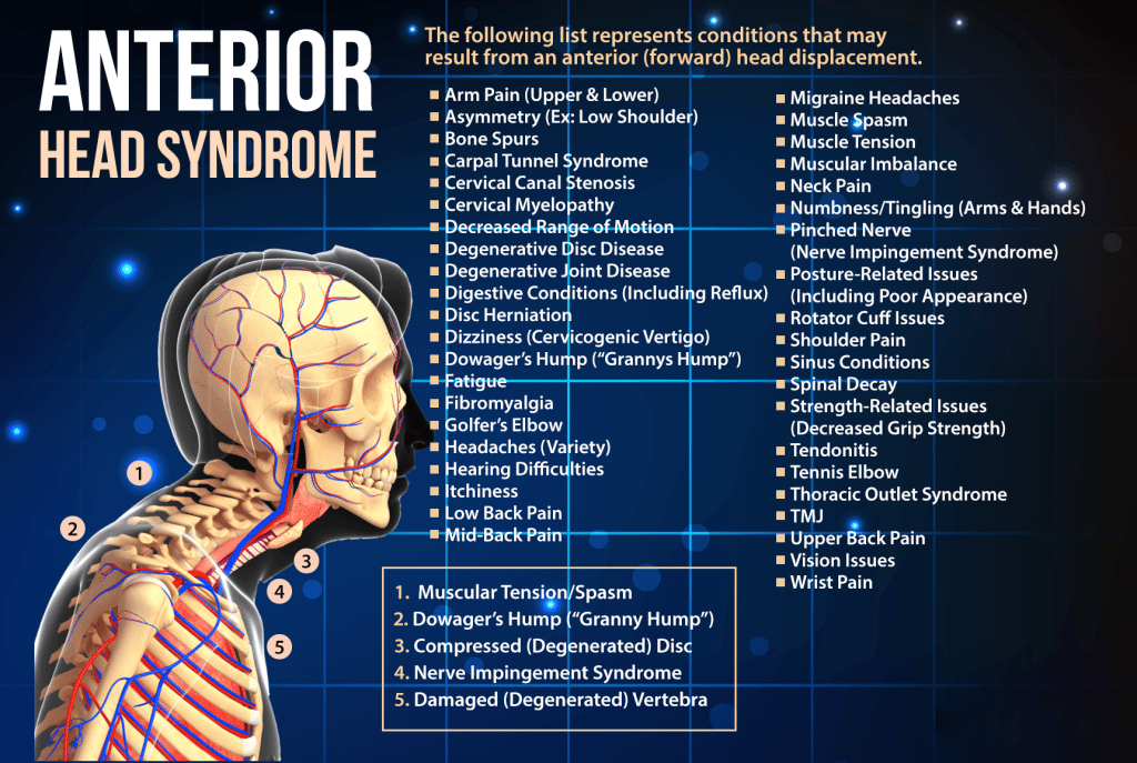blog infographic of human skeleton with the words anterior head syndrome and all the conditions that can result from forward head displacement