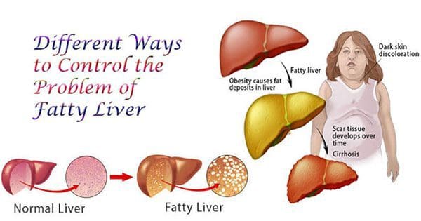 Foods That Help Your Liver After Drinking Foods That Help Your Liver After Drinking