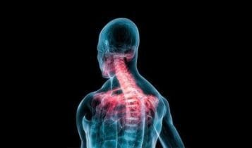 Whiplash Chiropractor El Paso, TX