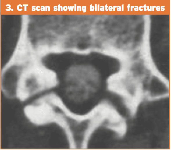 ct scan