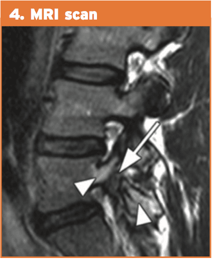 mri scan