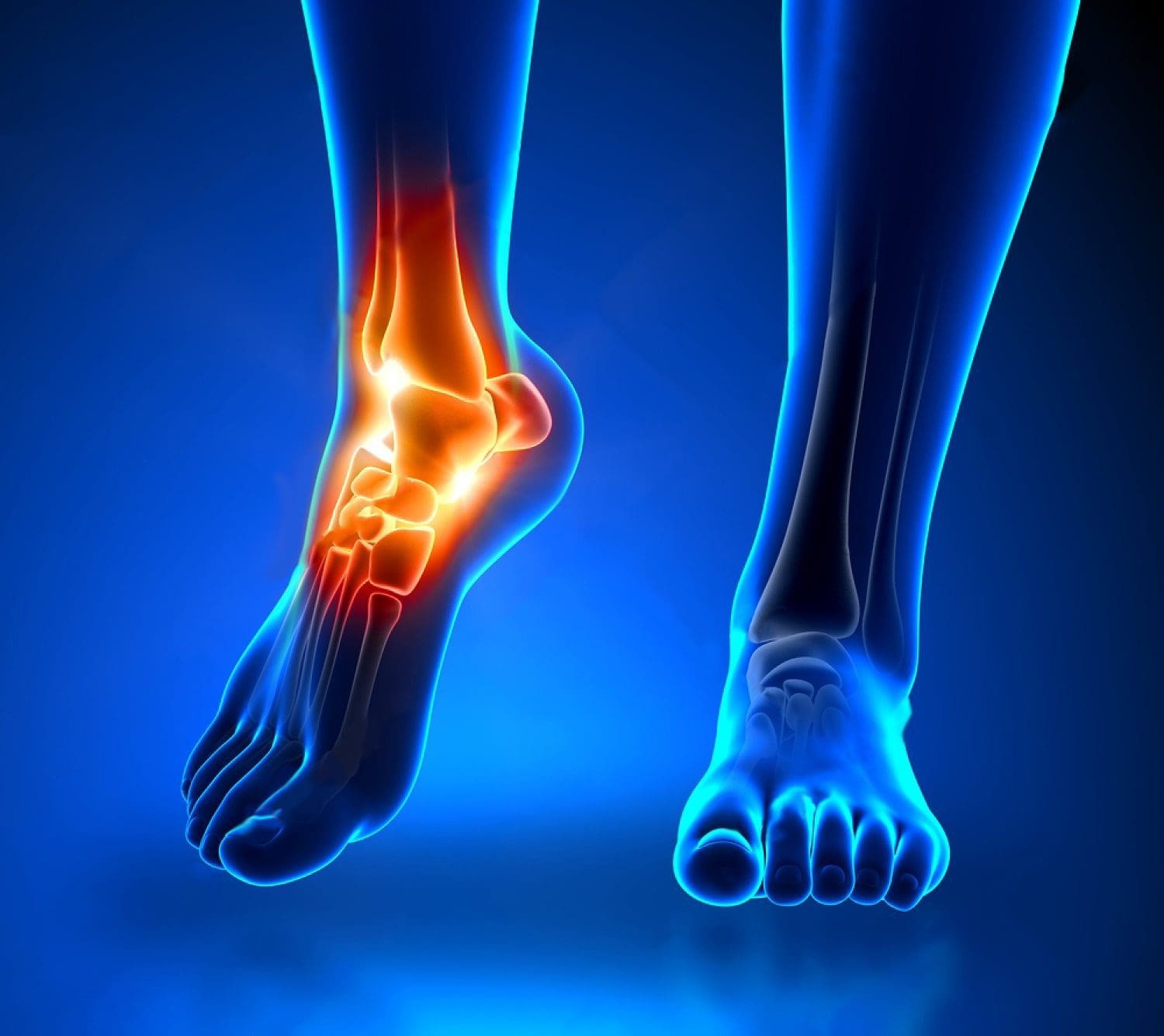 ankle arthritis pain in detail anatomy