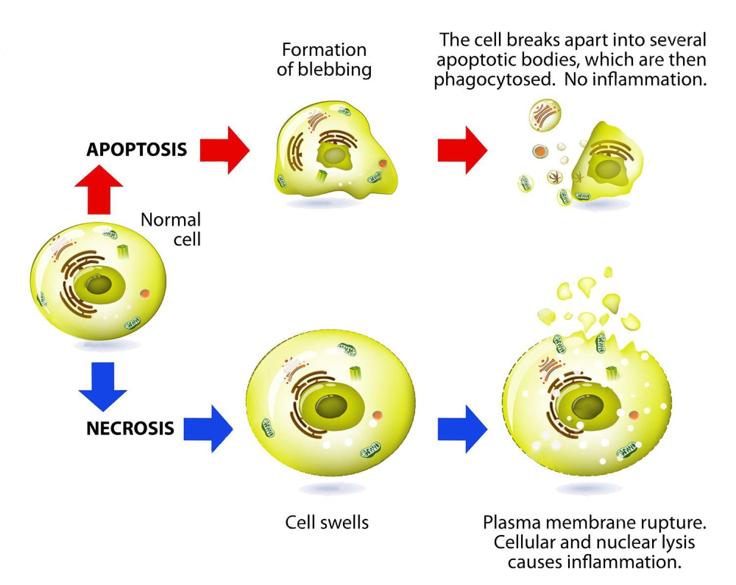 necrosis de la apoptosis de la medicina funcional