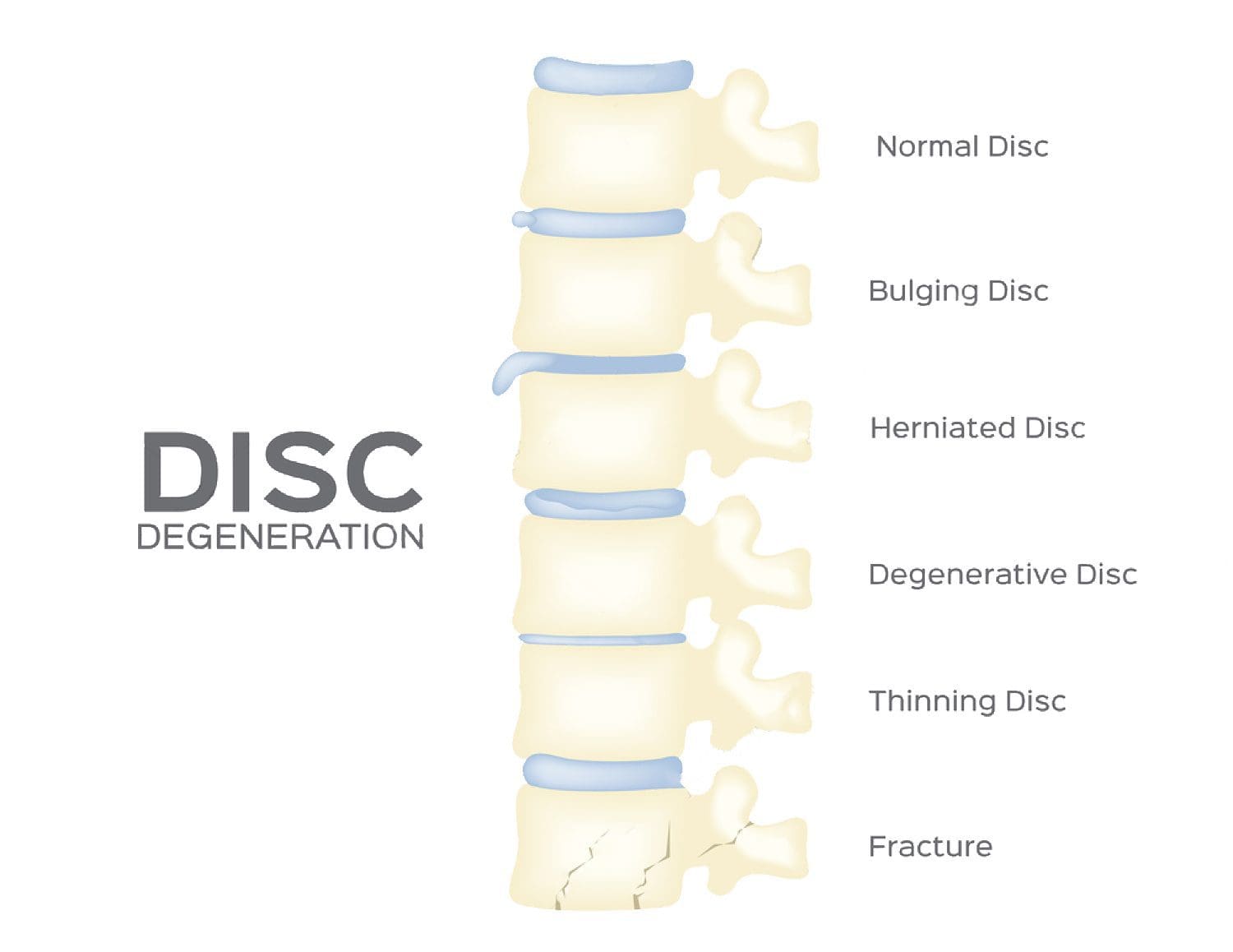 spinal manipulation el paso tx.