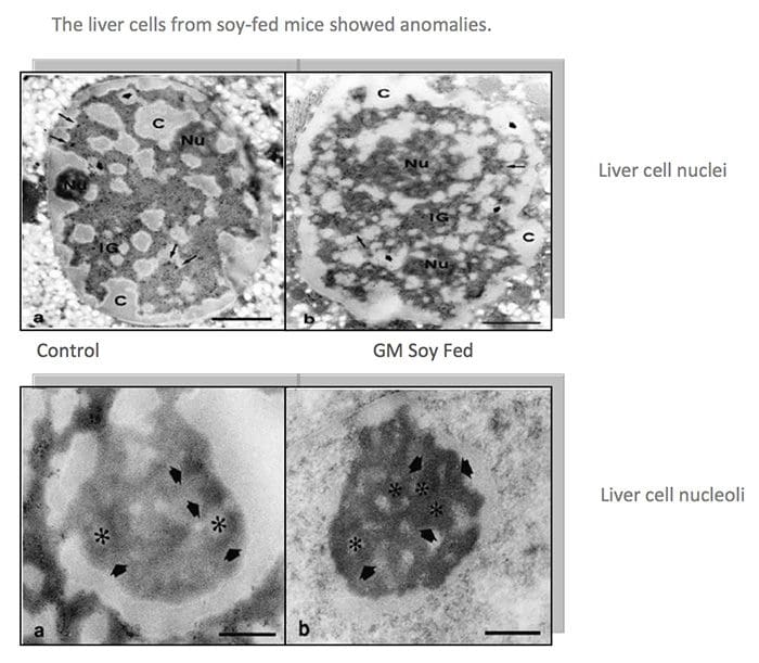 OGM Hígado Células Ratones de soja