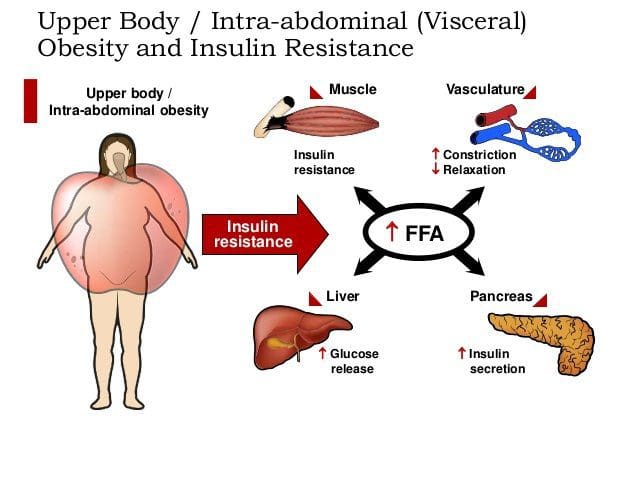 metabolic Visceral Adiposity Insulin resistance