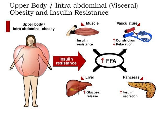 metabolica Visceral Adiposity Resistenza all'insulina