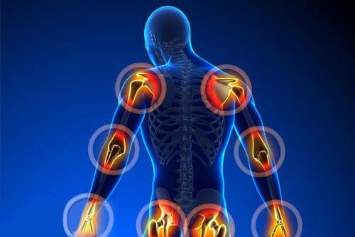 remedies-for-joint-pain-22589-1