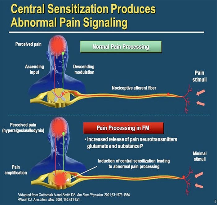 neuropatisk smerte el paso tx.