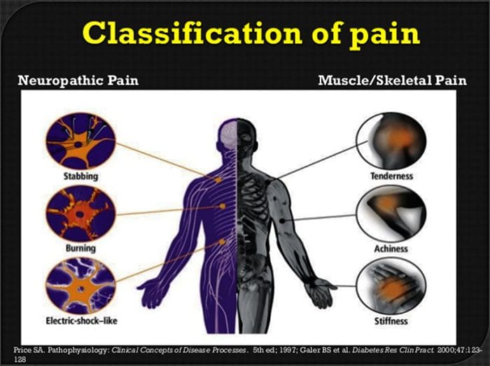 neuropathic pain el paso tx.