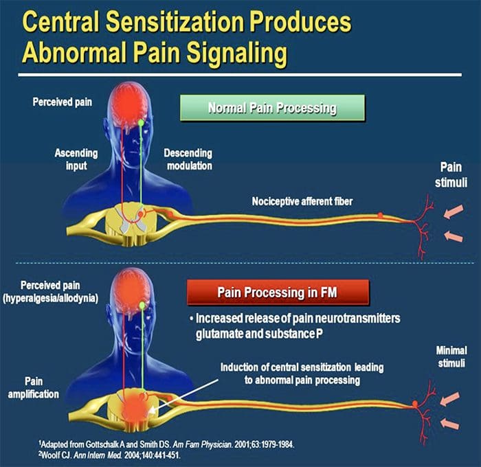 i-facetogenic neuropathic, i-osteoarthritis kunye neentloko zentlungu el paso tx.