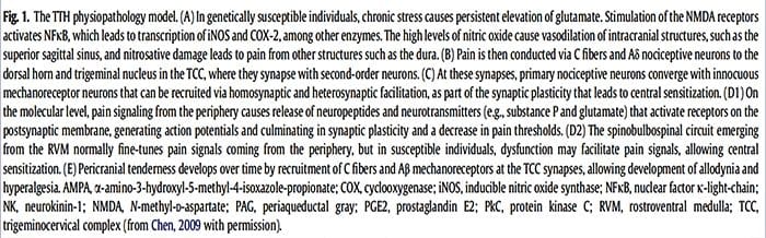 facetogenic neuropathic, osteoarthritis and headaches pain el paso tx.