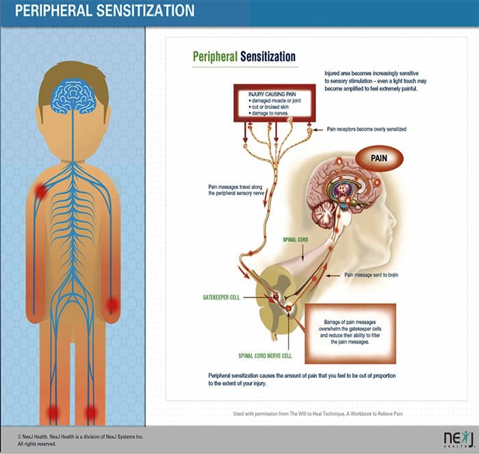 neuropathic facetogenic, osteoarthritis û pişkên êşa el el paso tx.