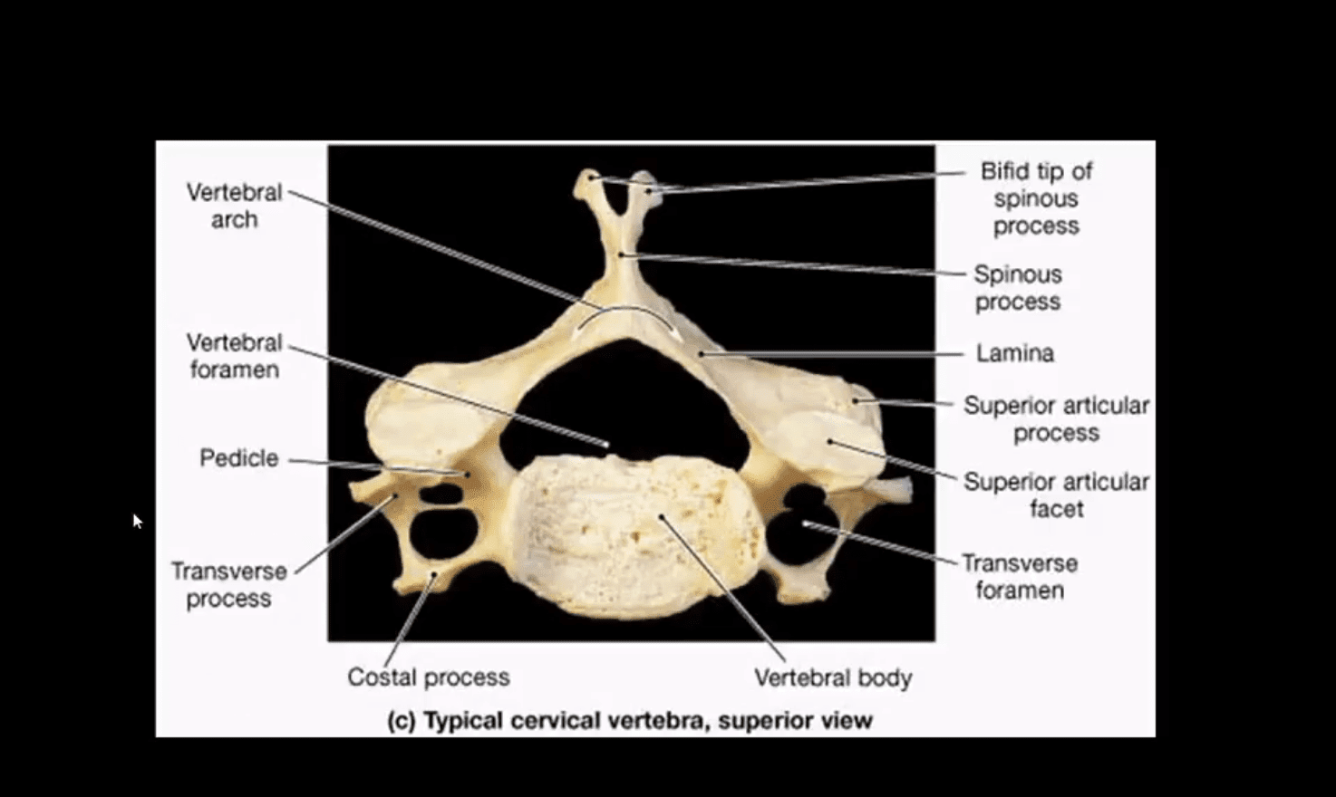 trauma espinhal el paso tx.