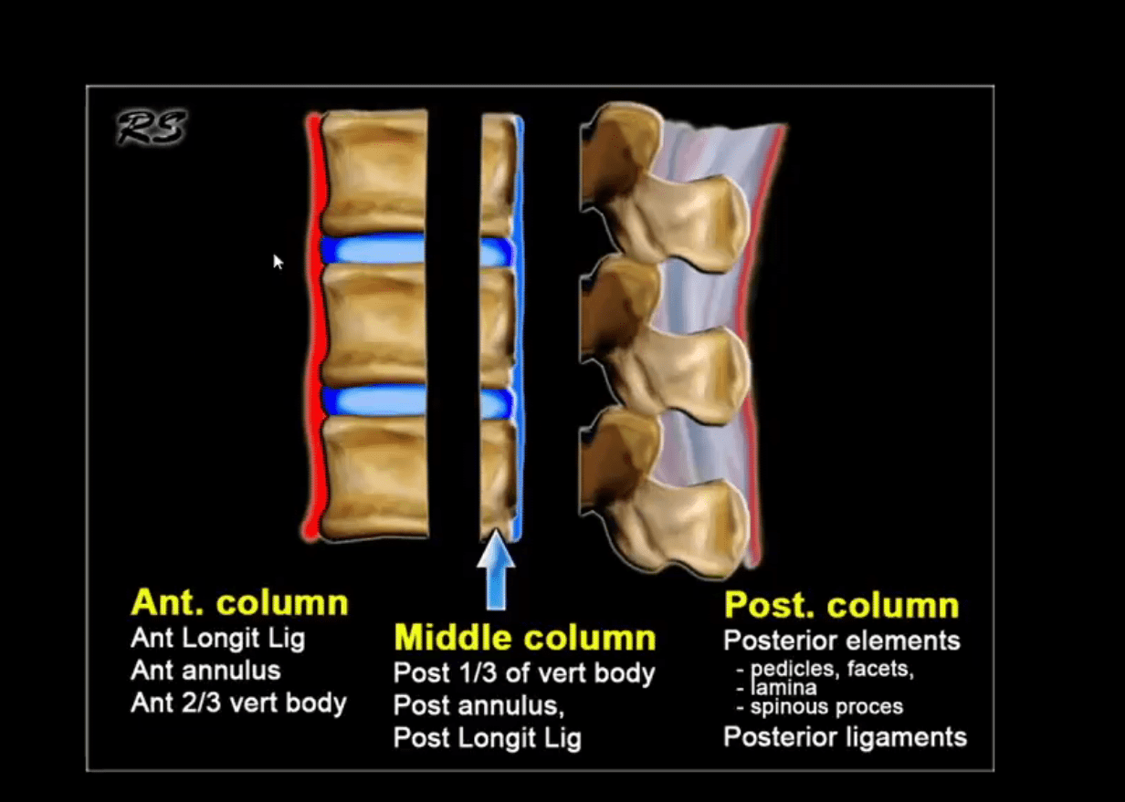 trauma spinale el paso tx.