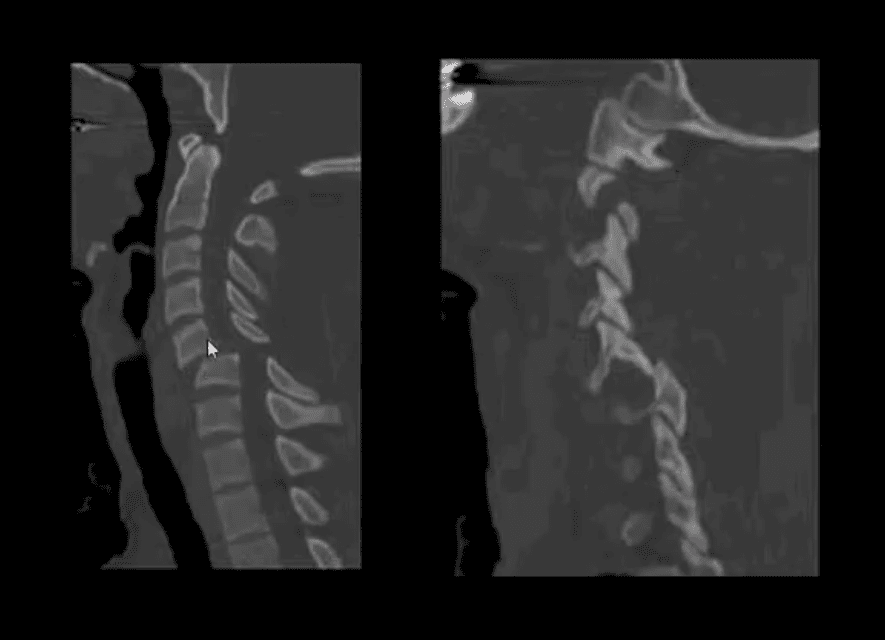 trauma chrbtice el paso tx.