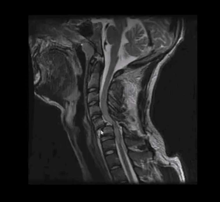 spinale trauma el paso tx.