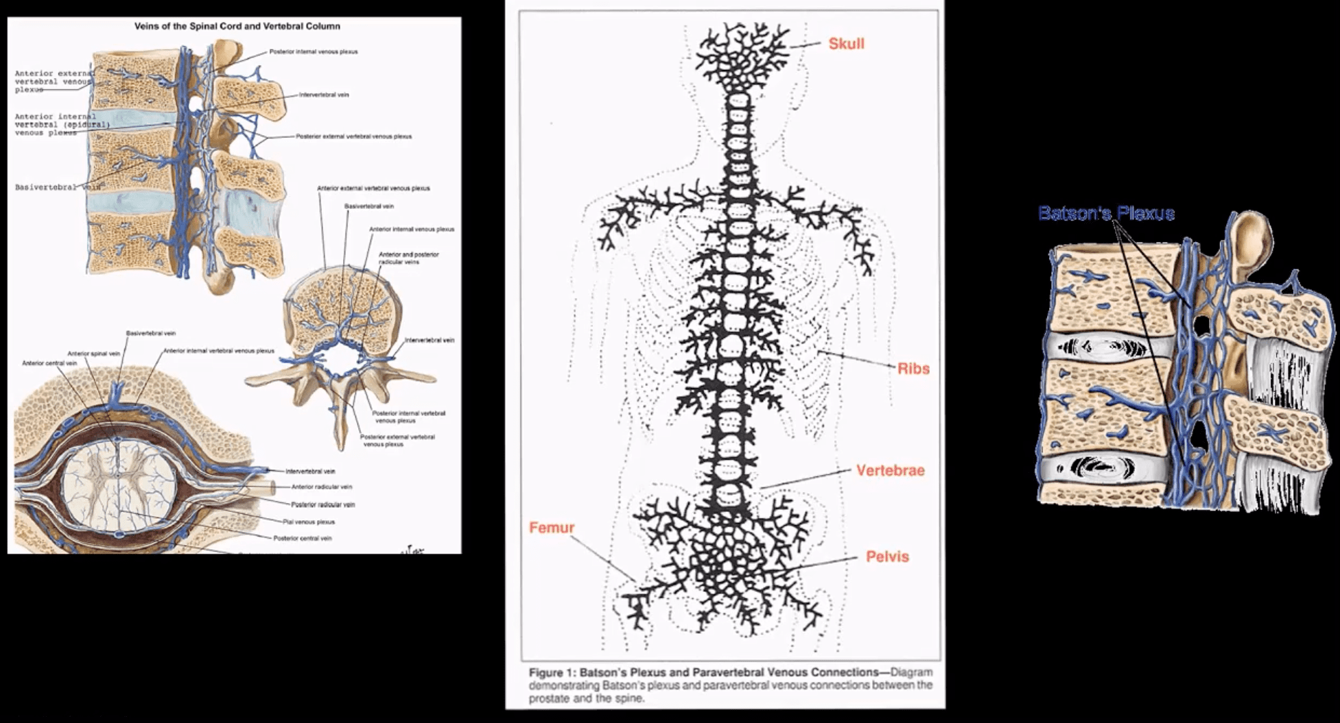 spinal neoplasms diagnostic imaging el paso tx.
