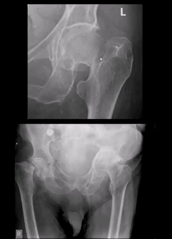 pelvi trauma el paso tx.