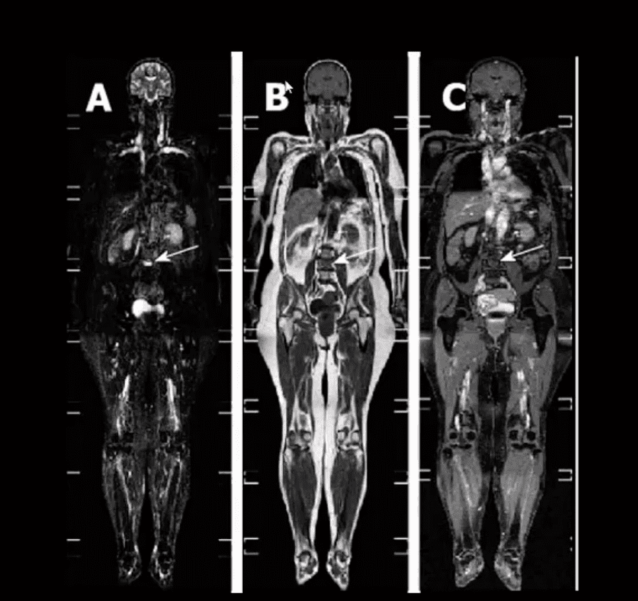 neoplasie diagnostica per immagini el paso tx.