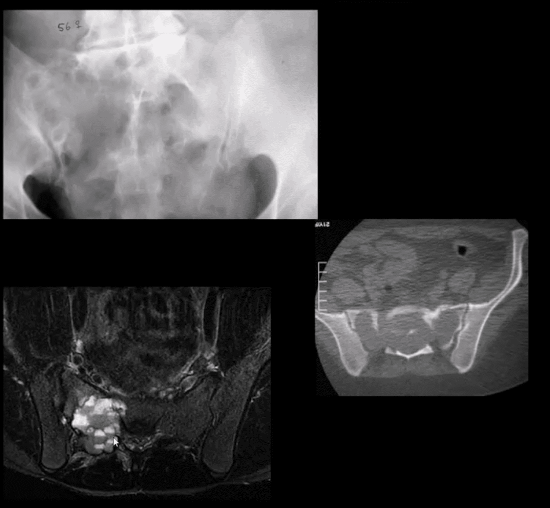 neoplasie diagnostica per immagini el paso tx.