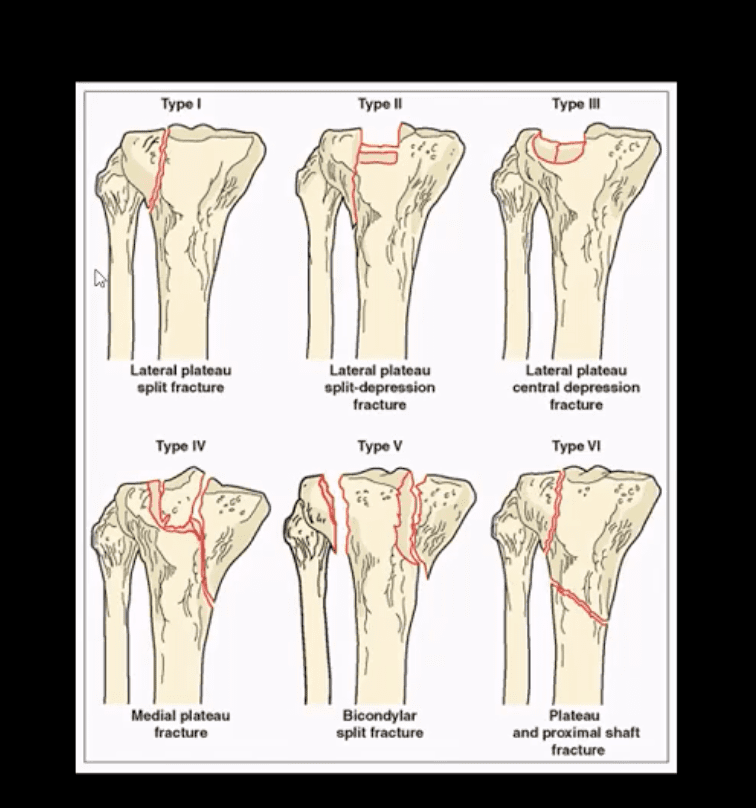 knee pain acute trauma el paso tx.