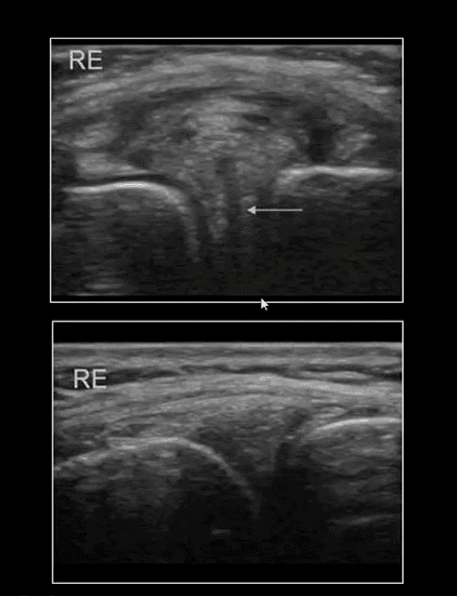 kniepijn acuut trauma el paso tx.