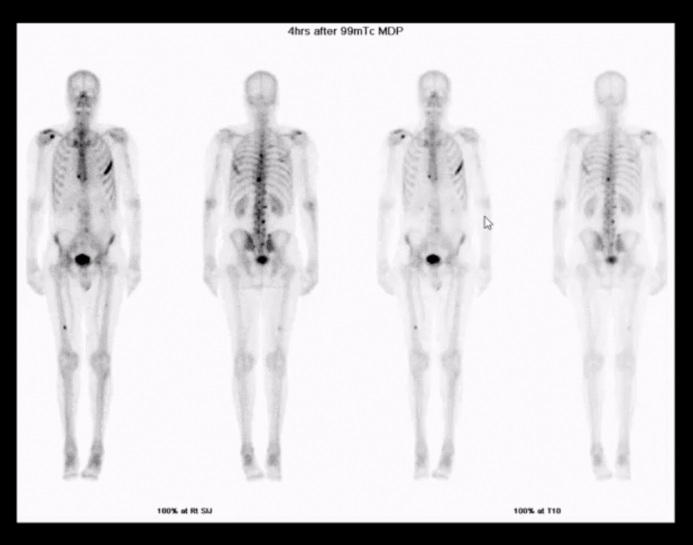 spinal neoplasms diagnostic imaging el paso tx.