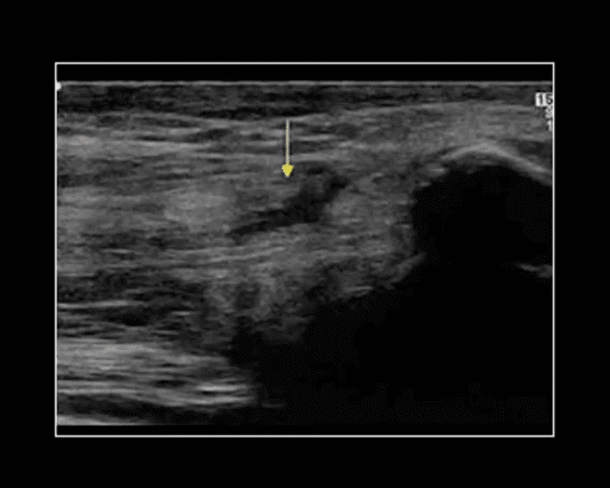 knee pain acute trauma el paso tx.
