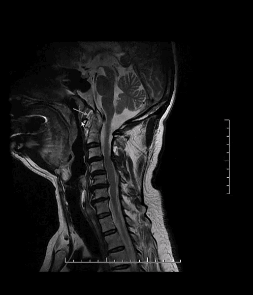 laf dhabarta arthritis el paso tx.