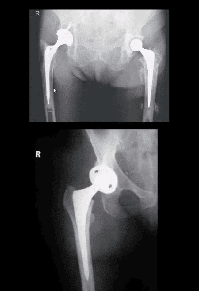 pelvi trauma el paso tx.