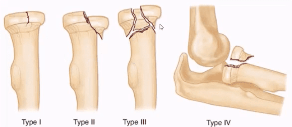 elbow imaging el paso tx.