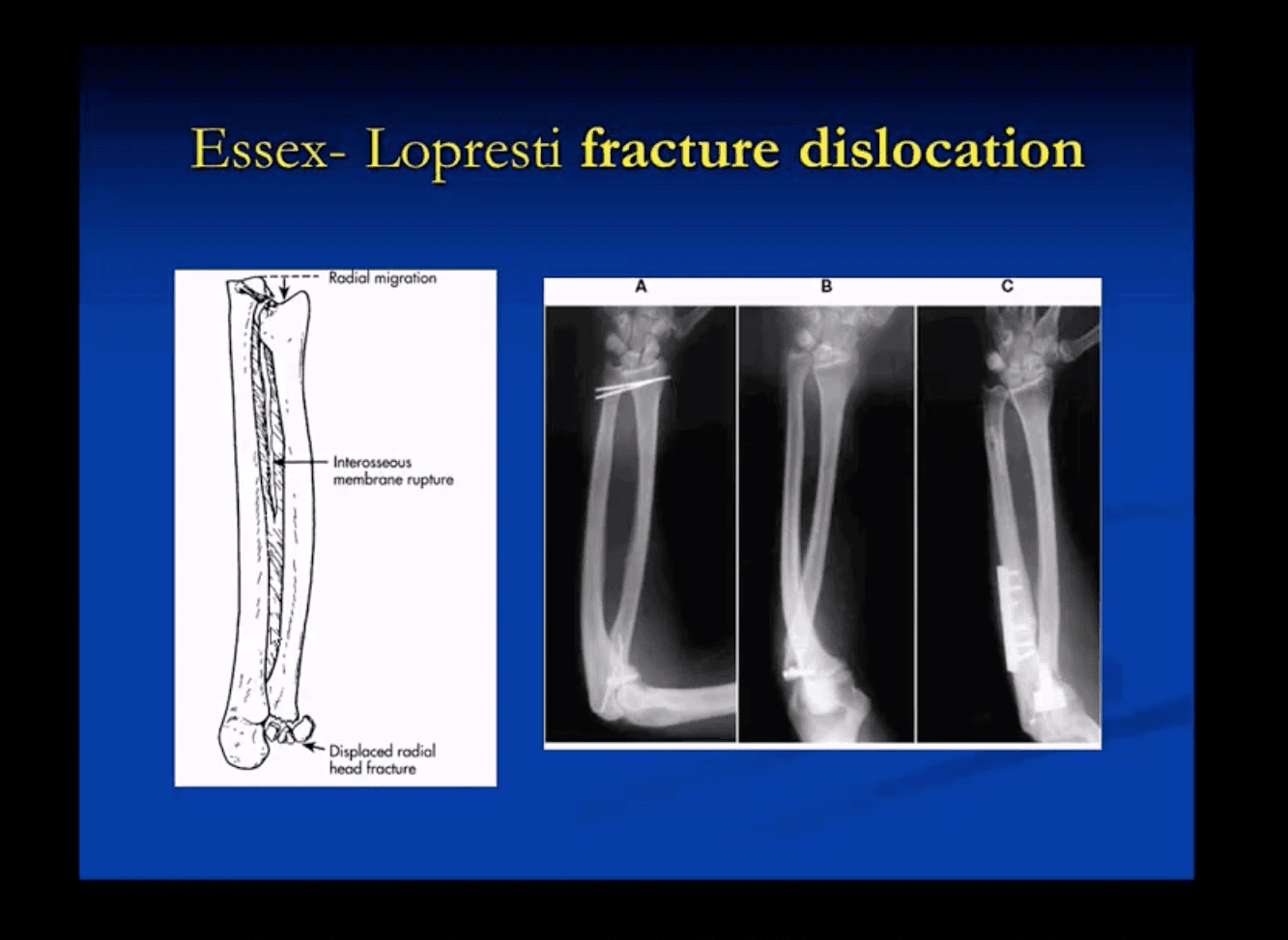 elbow imaging el paso tx.