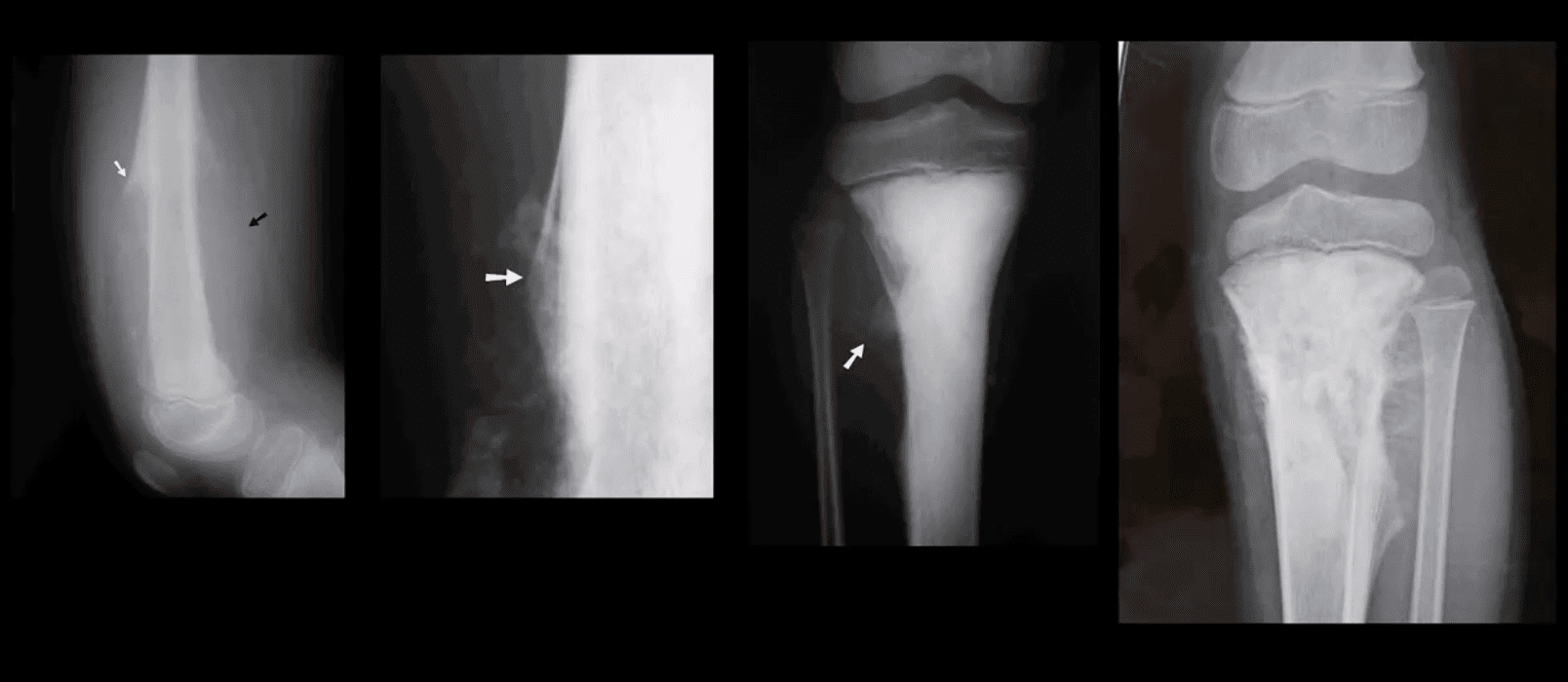 Dolor de rodilla tratamiento quiropráctico el paso tx.